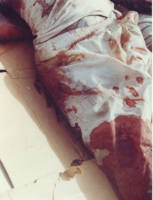 العقل المدبر لجريمة "البو صيفي" طبيب يعمل في أحد مستشفيات الحكومة (تقرير)