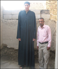 ثاني أطول رجل في العالم يعيش العزلة والحرمان والمرض في الديوانية