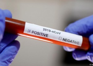 الصحة النيابية: العلاج العراقي لكورونا سيصنع في كردستان