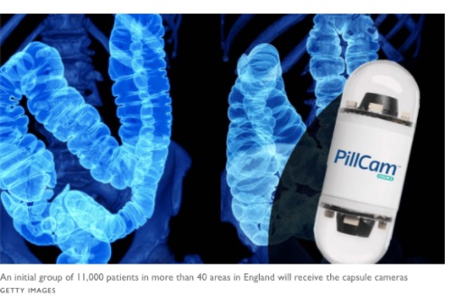 كاميرا في كبسولة يمكن ابتلاعها تصور الجسم من الداخل وتكشف العلامات المبكرة للسرطان