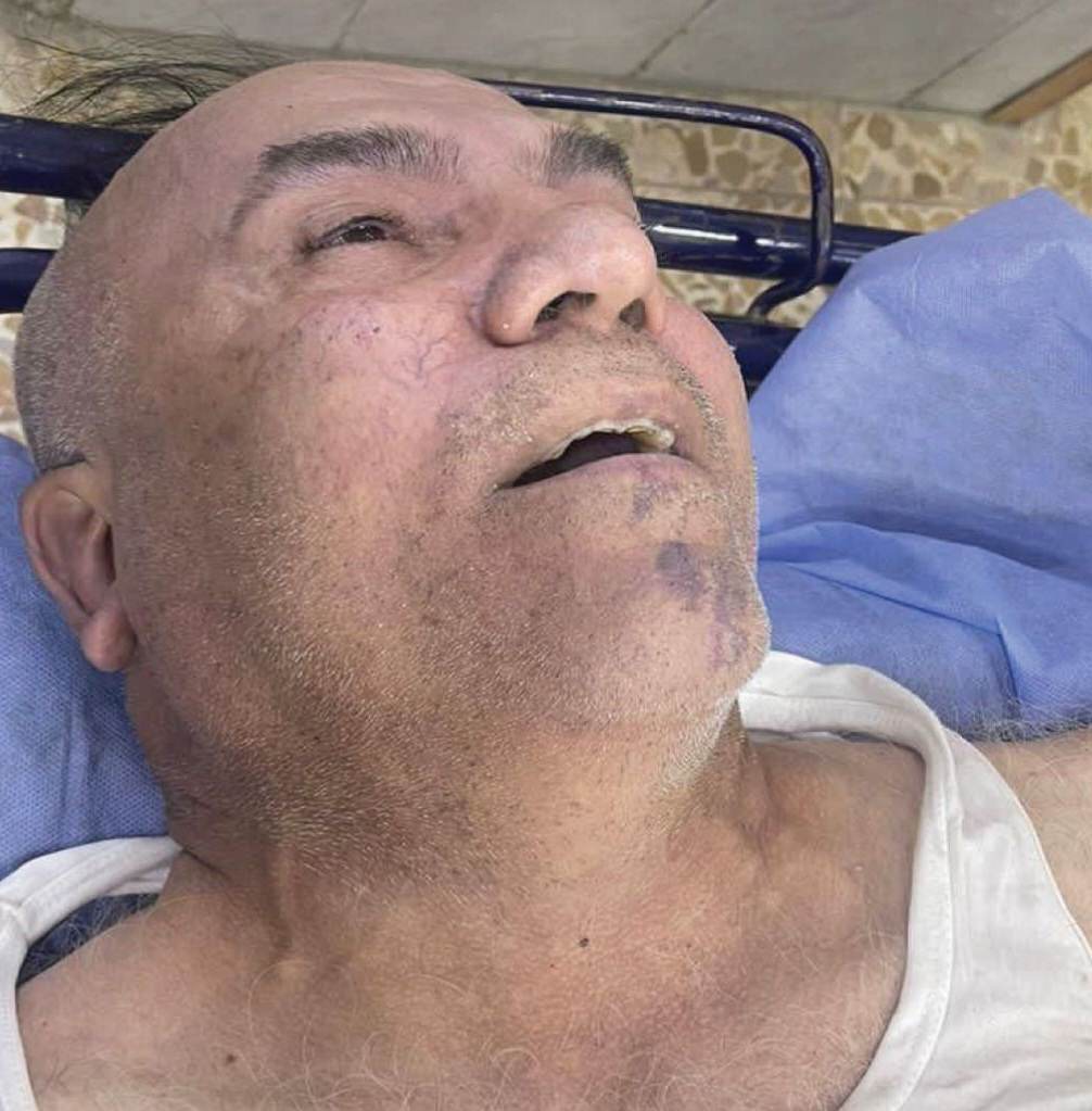 الداخلية والصحة: كمبش وصل متوفياً للمستشفى بعد اصابته بالاعياء اثناء المطاردة