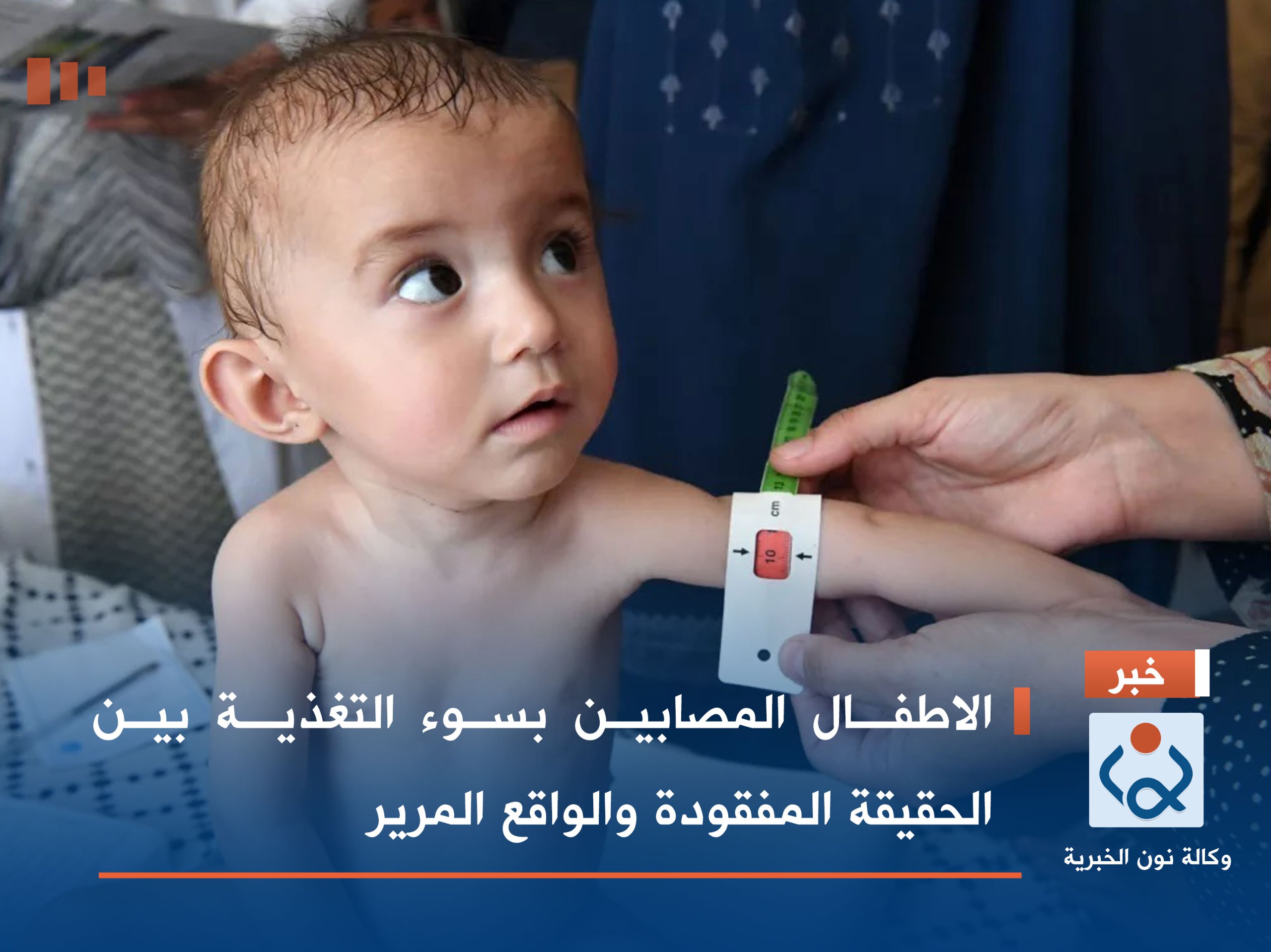 الاطفـال المصابين بسوء التغذيـة بين الحقيقة المفقودة والواقع المرير