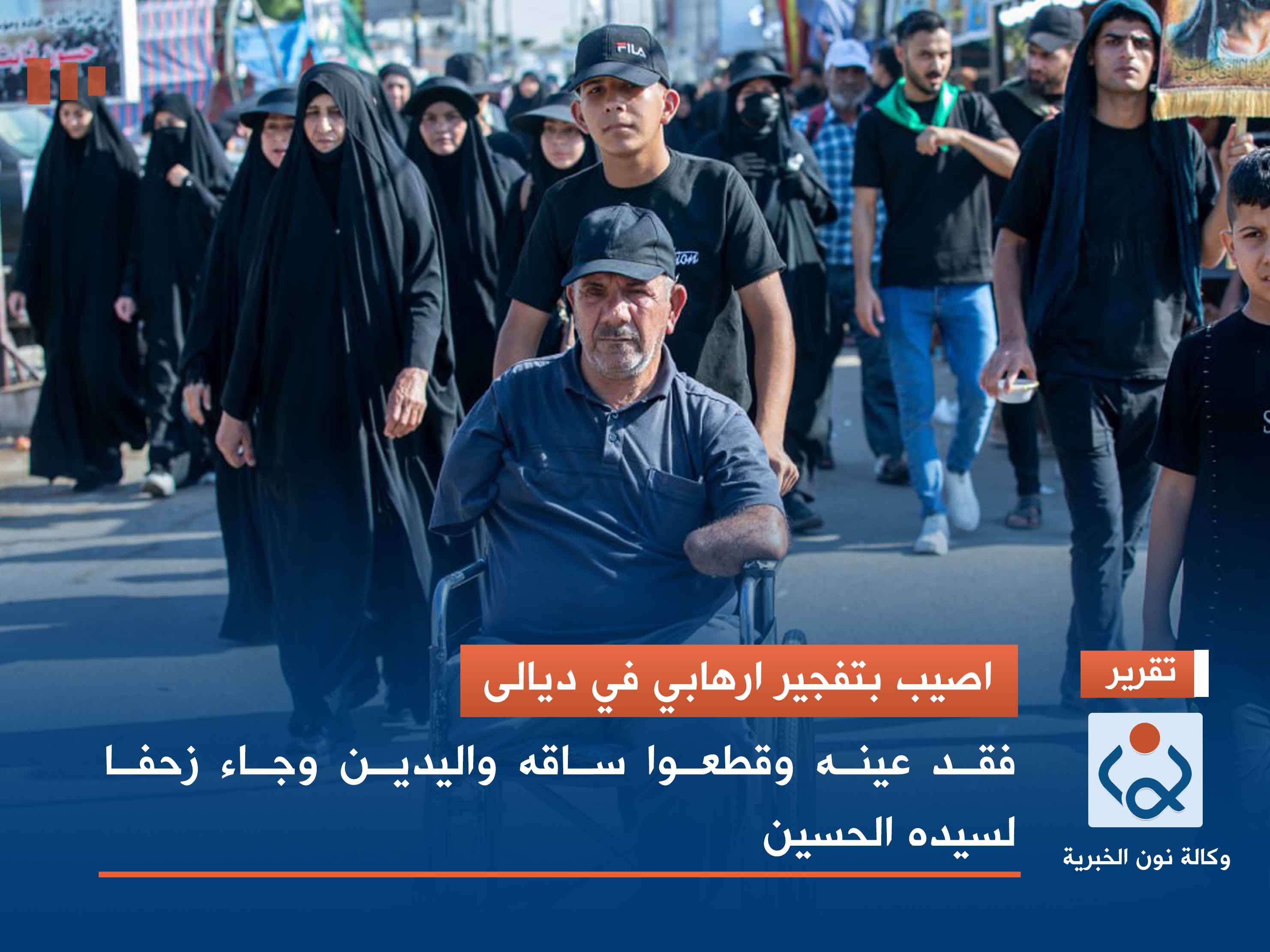 اصيب بتفجير ارهابي في ديالى... فقد عينه وقطعوا ساقه واليدين وجاء زحفا لسيده الحسين