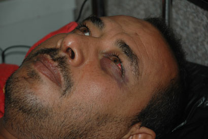 ضباط يعتدون على خدام زوار الامام الحسين وينهالون عليهم ضربا حتى الاغماء (مصور)