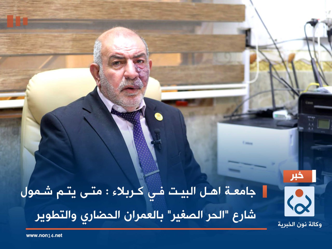 جامعة اهل البيت في كربلاء : متى يتم شمول شارع "الحر الصغير" بالعمران الحضاري والتطوير