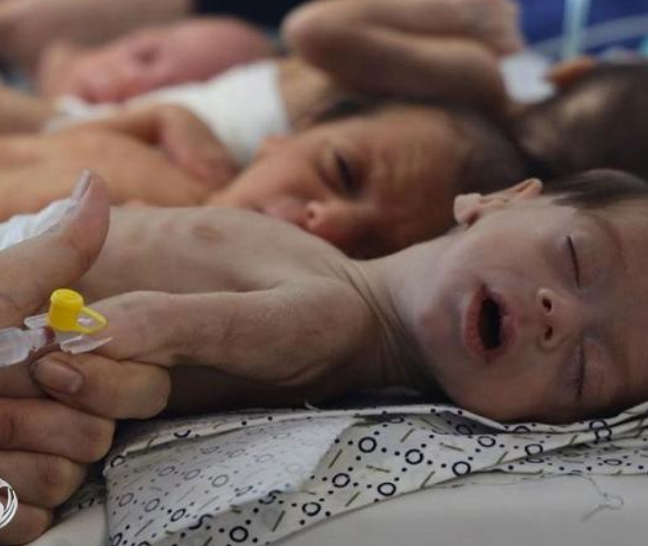 الأمم المتحدة: 14 ألف رضيع مهددون بالموت خلال 48 ساعة في غزة