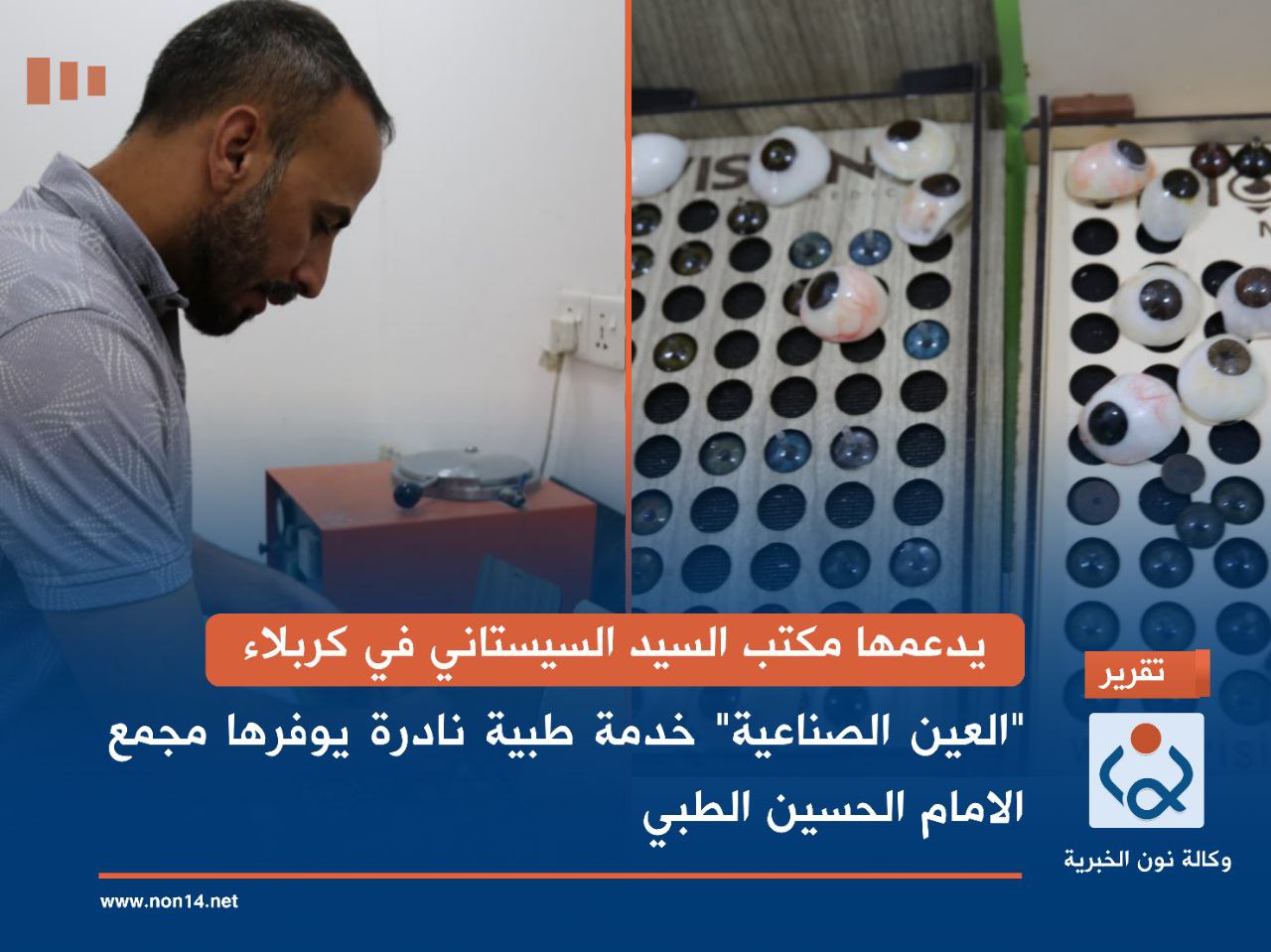 يدعمها  مكتب السيد السيستاني في كربلاء.. "العين الصناعية" خدمة طبية نادرة يوفرها مجمع الامام الحسين الطبي
