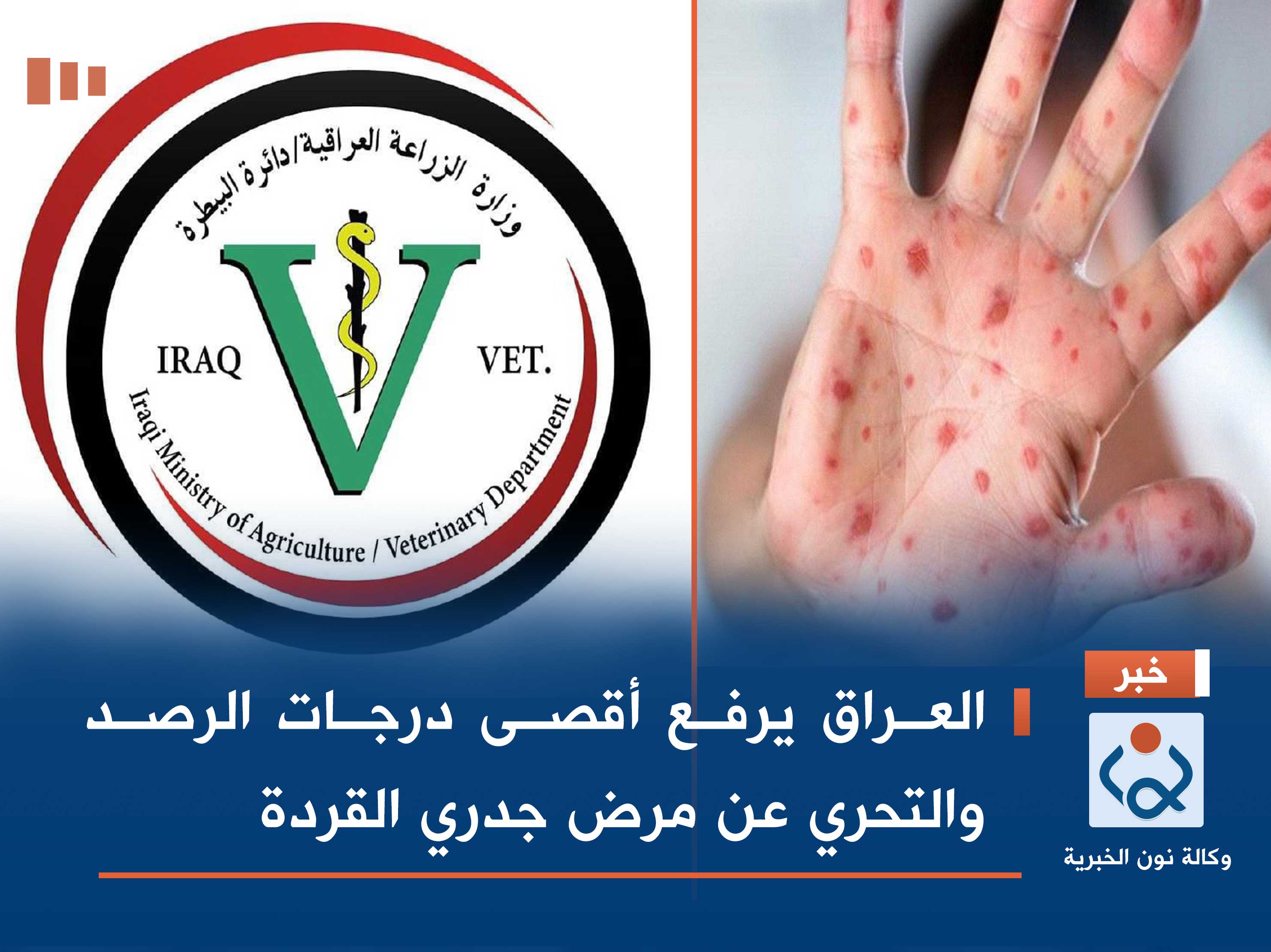 العراق يرفع أقصى درجات الرصد والتحري عن مرض جدري القردة