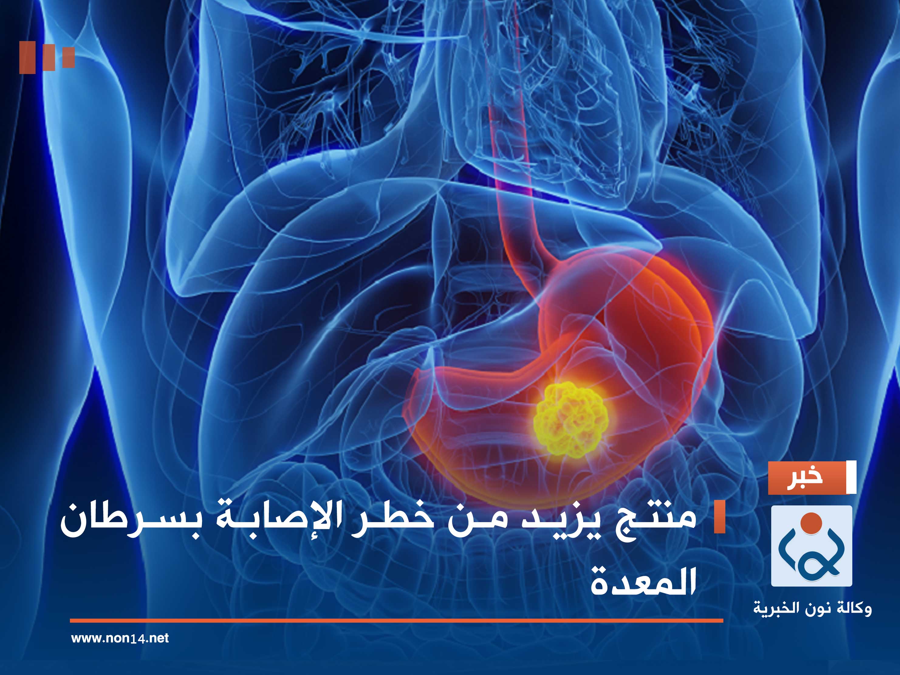 منتج يزيد من خطر الإصابة بسرطان المعدة