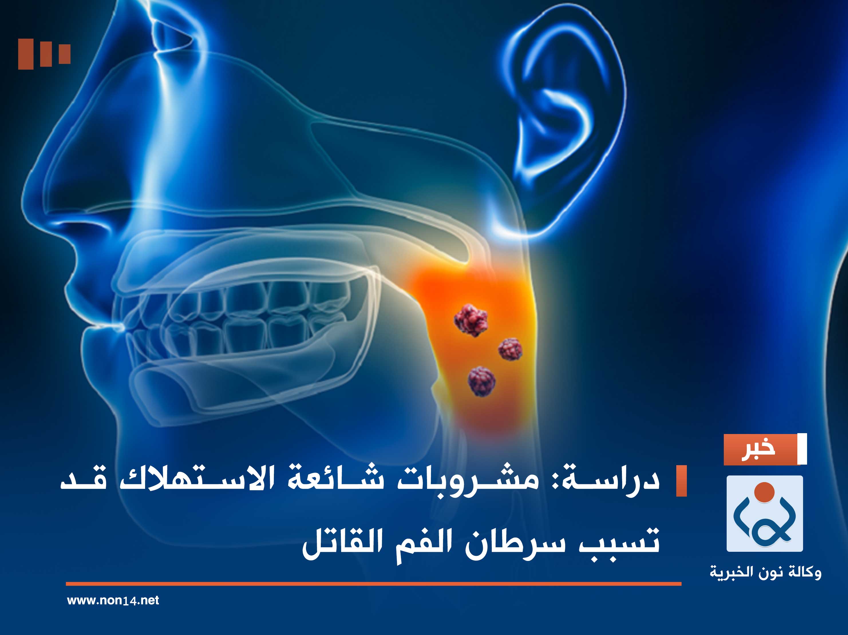 دراسة: مشروبات شائعة الاستهلاك قد تسبب سرطان الفم القاتل