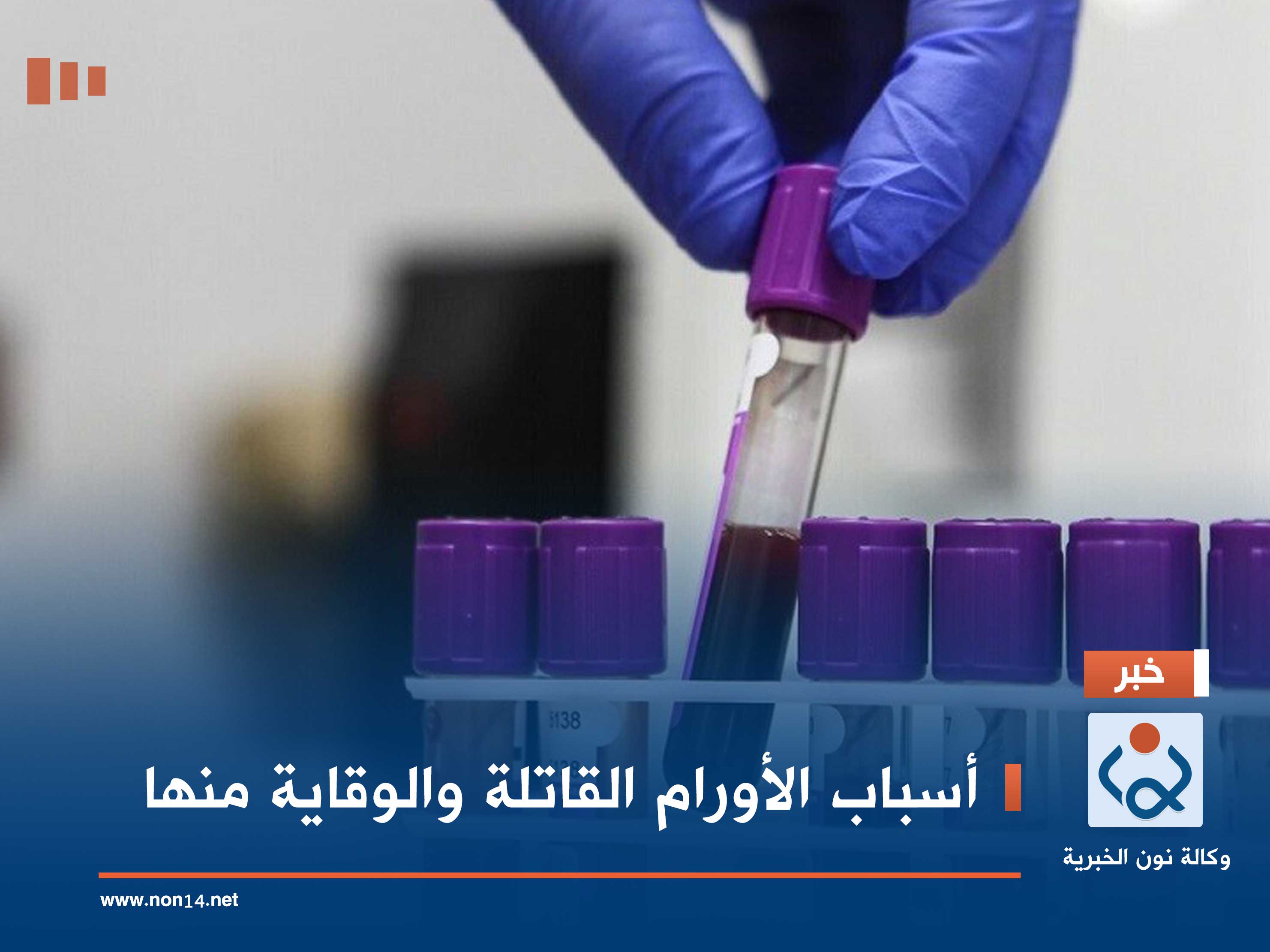 أسباب الأورام القاتلة والوقاية منها