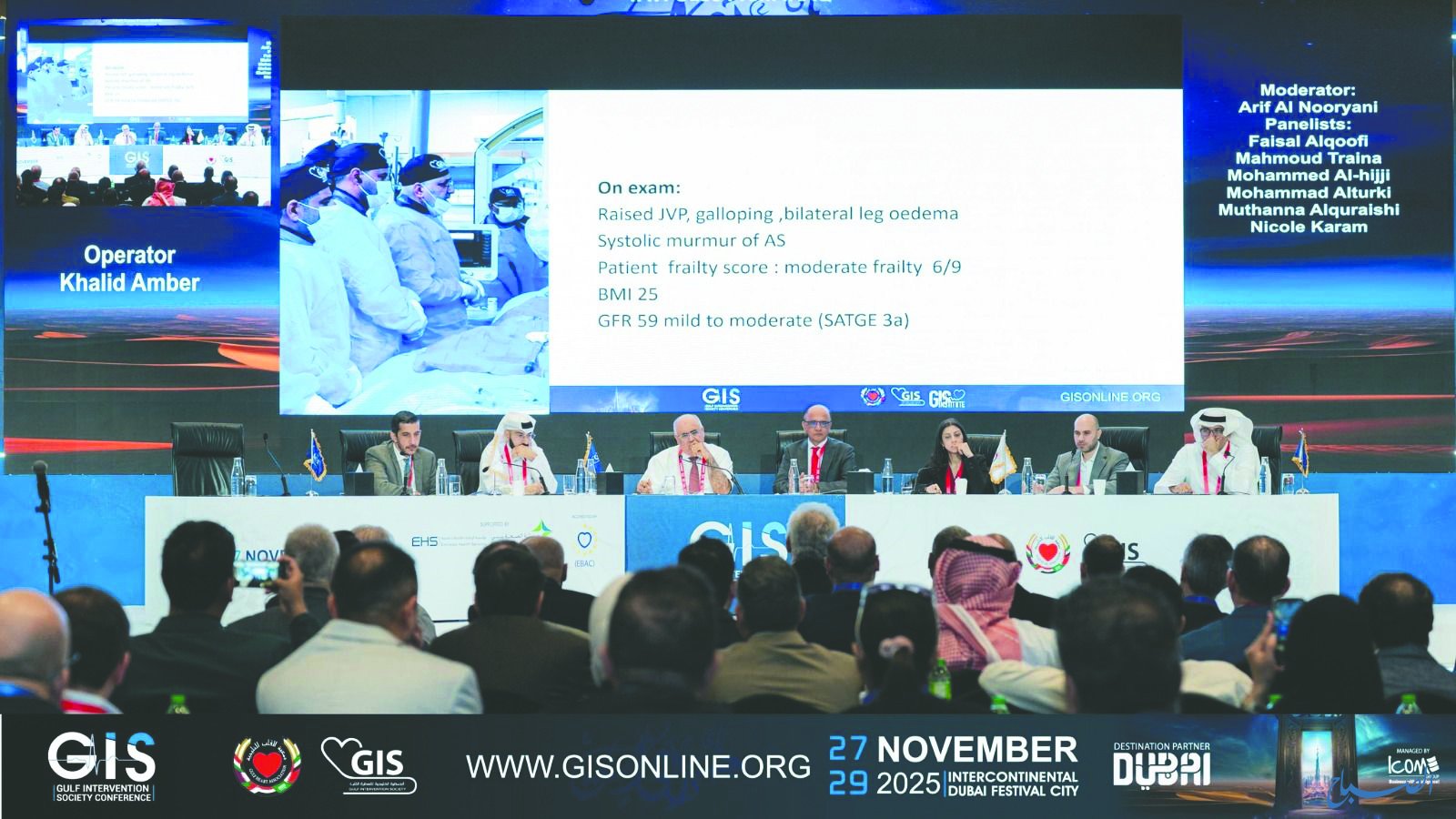 العراق يسجل رقماً عالمياً بزراعة صمام القلب