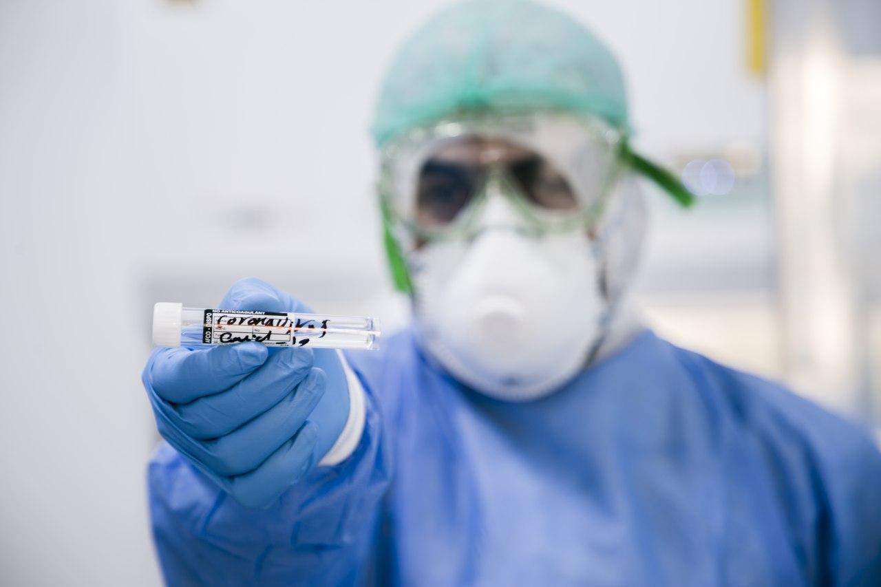 بغداد تسجل اعلى الحالات .. الصحة تعلن عن 67 اصابة جديدة بفيروس كورونا في العراق