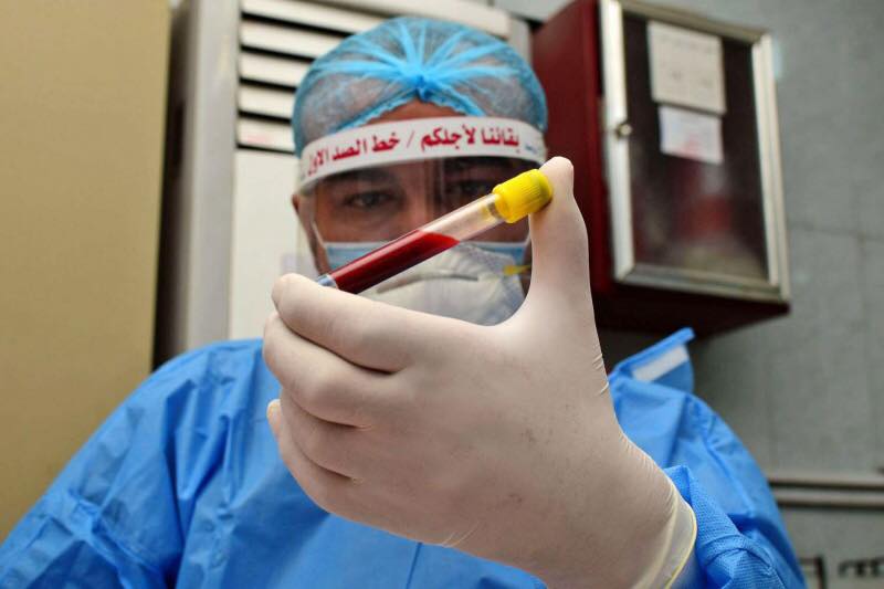 كورونا في العراق .. وفاة 95 شخصاً واصابة 2312 آخرين خلال 24 ساعة