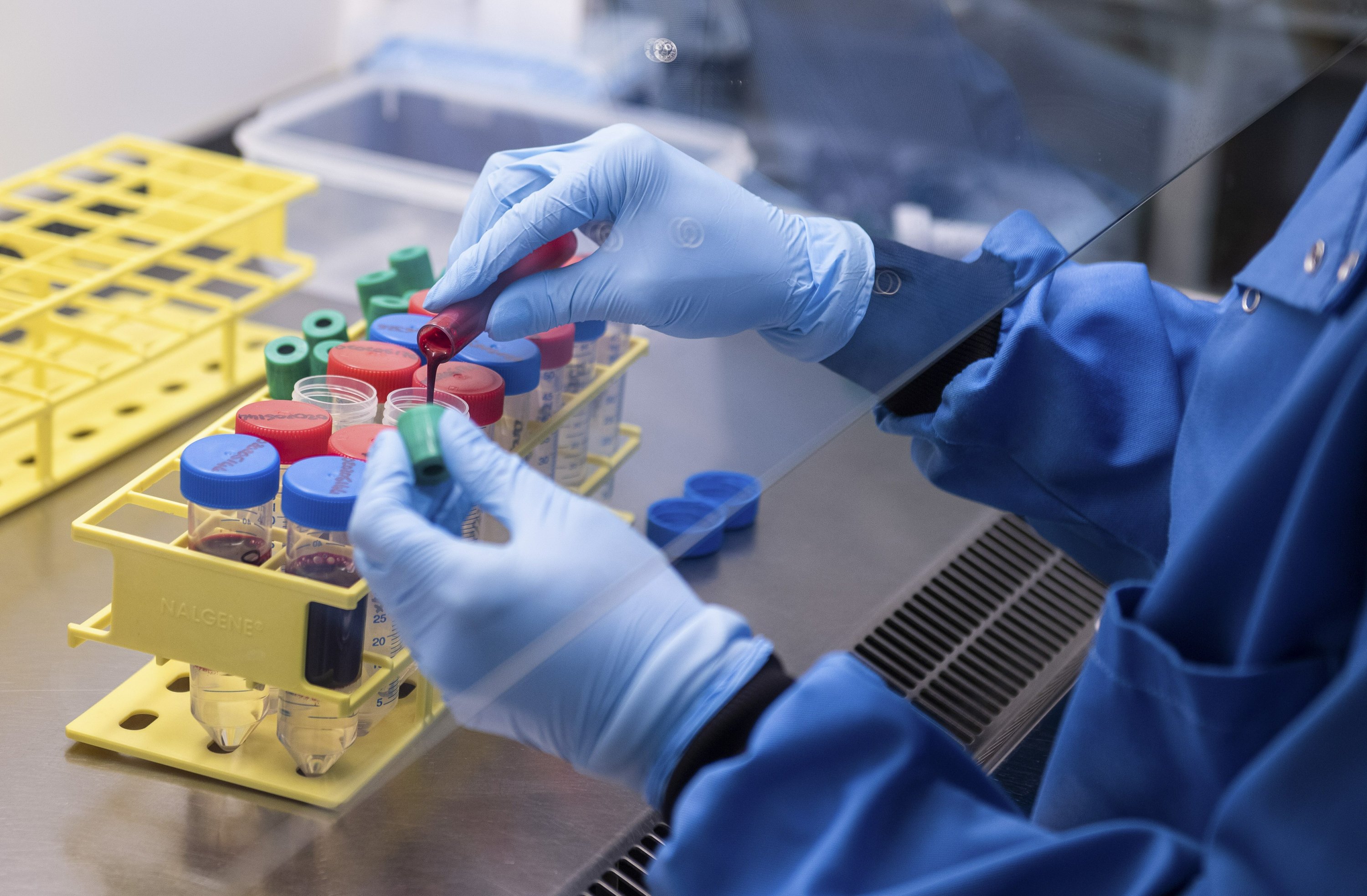 كيف يصيب فيروس كورونا الإنسان؟ خبراء يجيبون