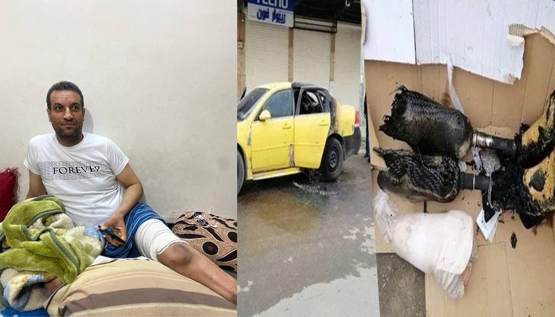 العتبة الحسينية تتكفل بعلاج مواطن من ذوي الاحتياجات الخاصة أضرم النار بسيارته في كركوك (صور)