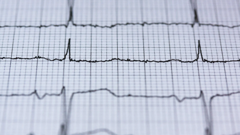 ما هي العلامات الأقل شهرة للنوبة القلبية الخطيرة؟