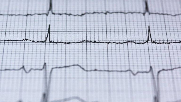 علامات "غير عادية" لأمراض القلب تظهر على الجلد !