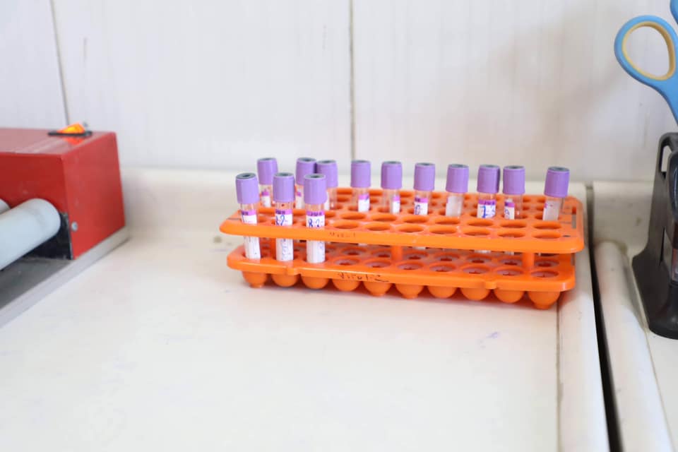 الصحة البرلمانية تكشف أسباب انخفاض الإصابات بكورونا في العراق