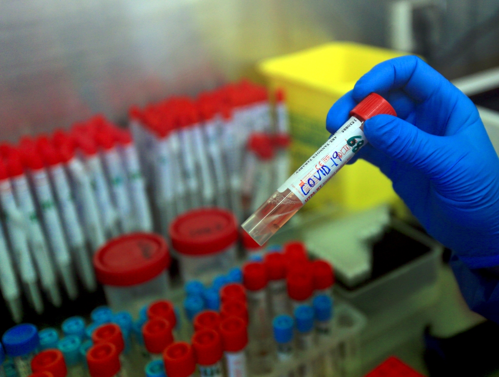 أكاديمية الطب الأمريكية: جائحة أخطر من تفشي كورونا قد تندلع في أي لحظة