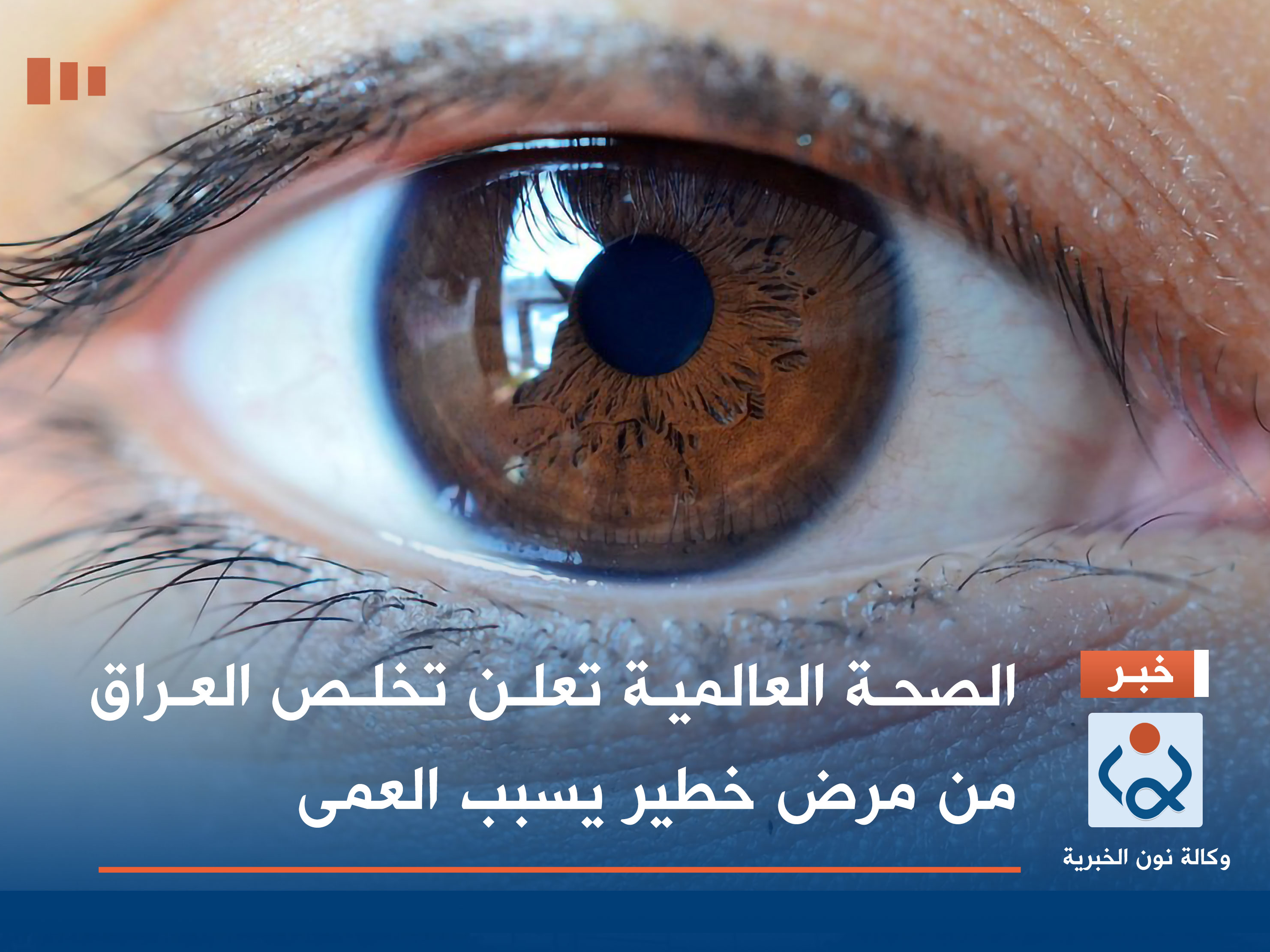 الصحة العالمية تعلن تخلص العراق من مرض خطير يسبب العمى