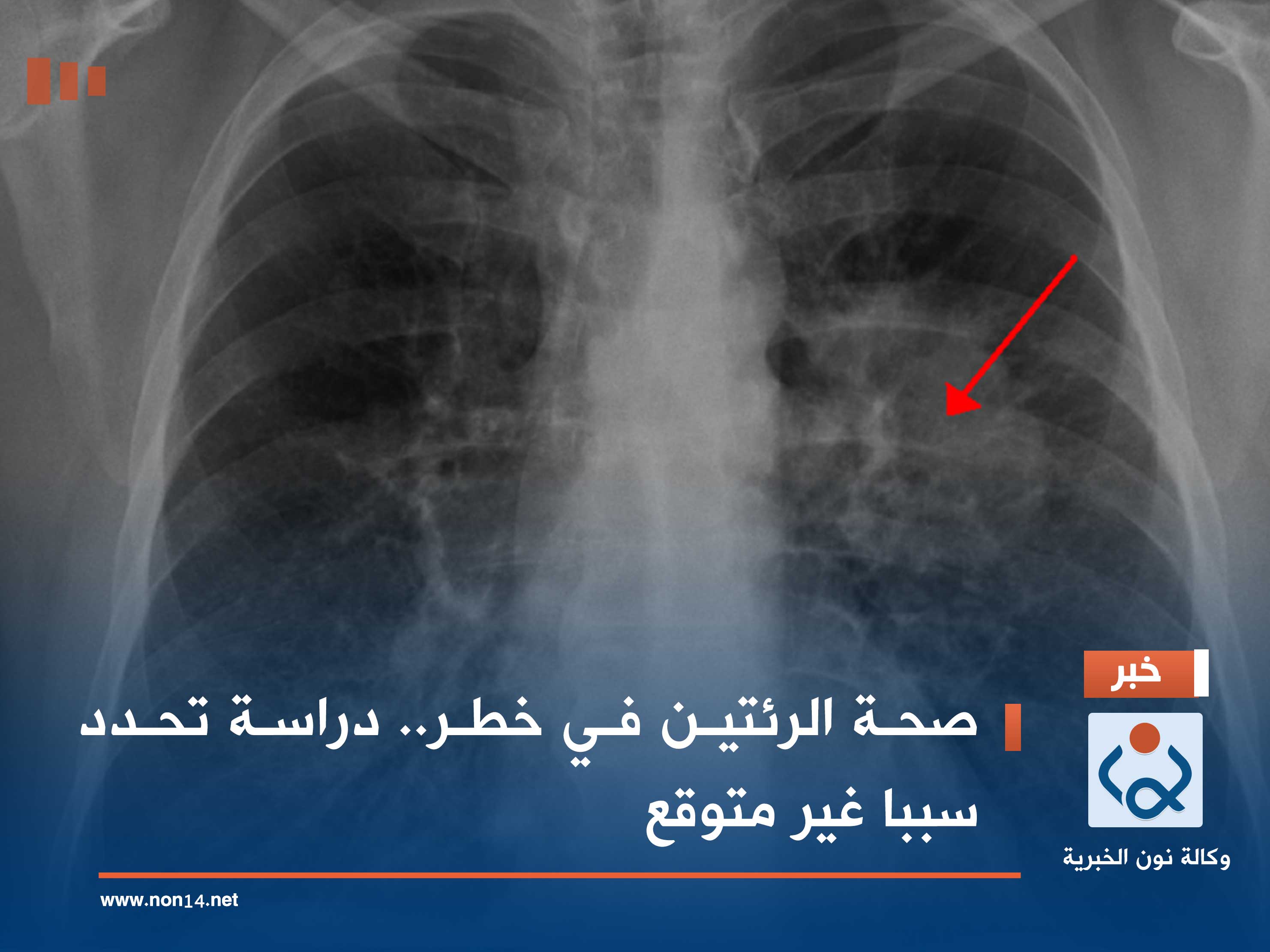 صحة الرئتين في خطر.. دراسة تحدد سببا غير متوقع