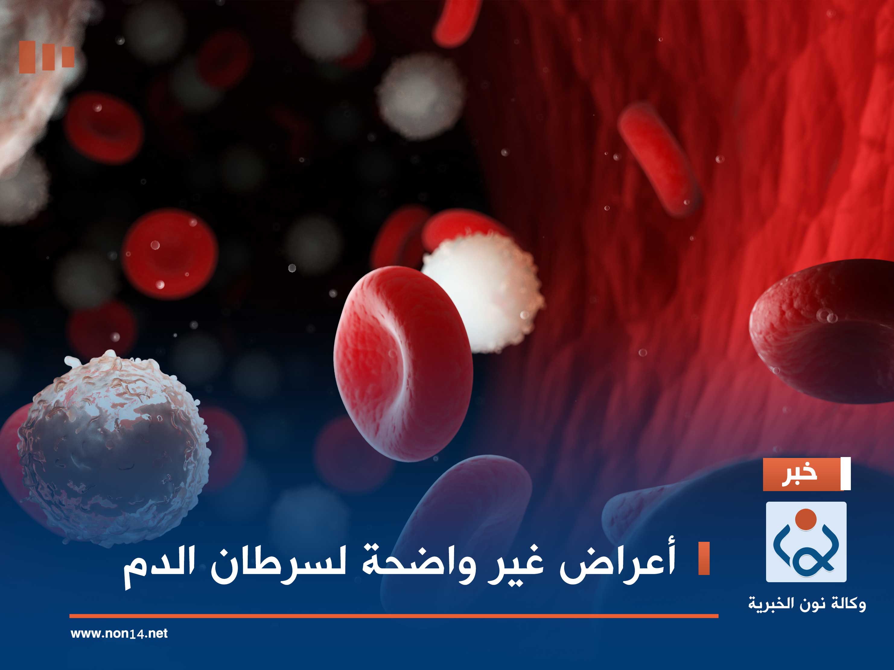 أعراض غير واضحة لسرطان الدم