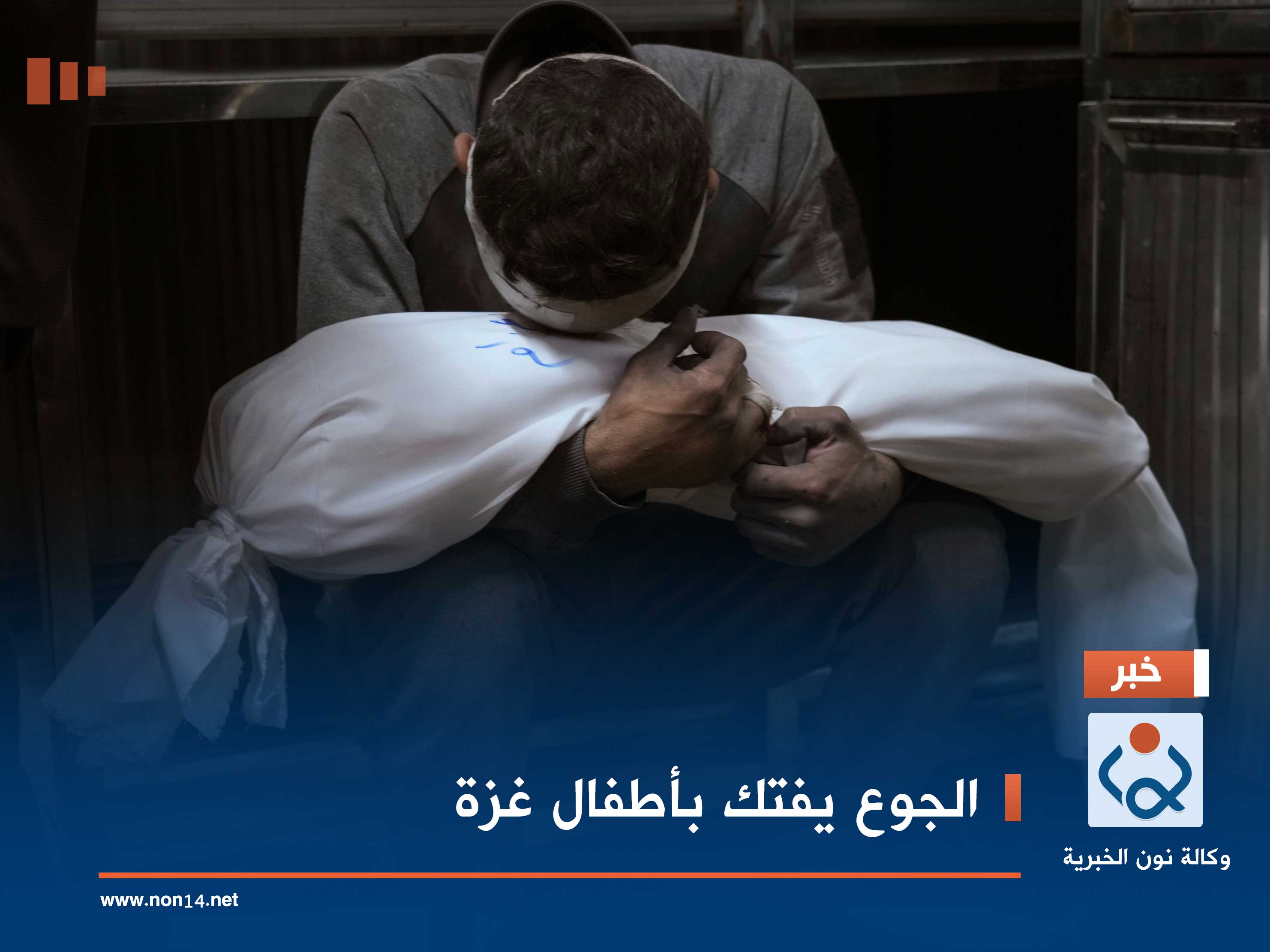 الجوع يفتك بأطفال غزة