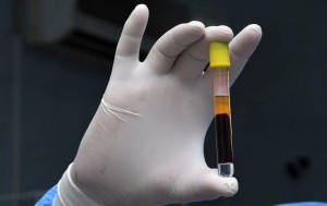 الصحة: لقاح كورونا في مرحلة التجارب النهائية وسيوزع فور الانتهاء