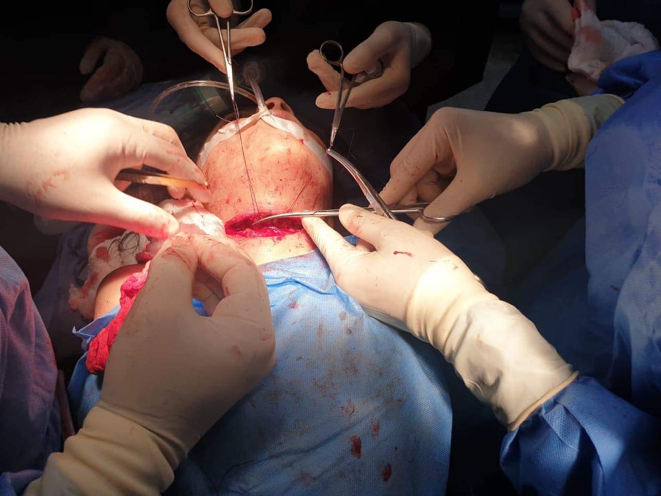 بالصور:أٔم تنْحُر طِفلتِها بكربلاء والعنايةُ الإلهية ومُهارة الاطباء تُنقِذها من مُوتٍ مُحَقق