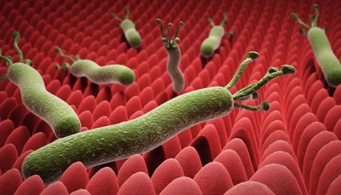 ثلثا سكان العالم ‏مصابون بجرثومة المعدة