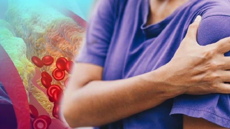أعراض ارتفاع الكوليسترول.. علامات تحذيرية في الذراعين والساقين