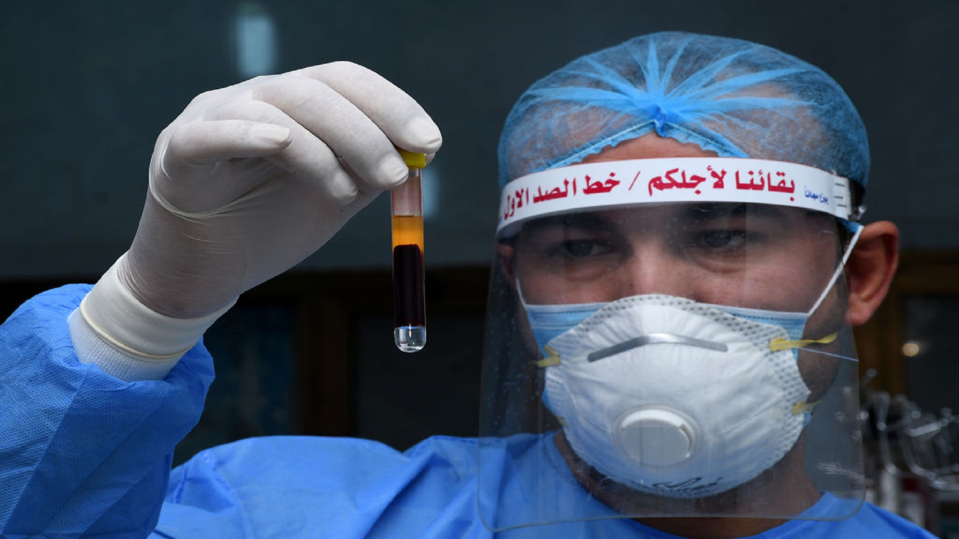 بالجدول :الموقف الوبائي بالعراق يسجل حالة وفاة واحدة مع 230 إصابة خلال ال24 ساعة