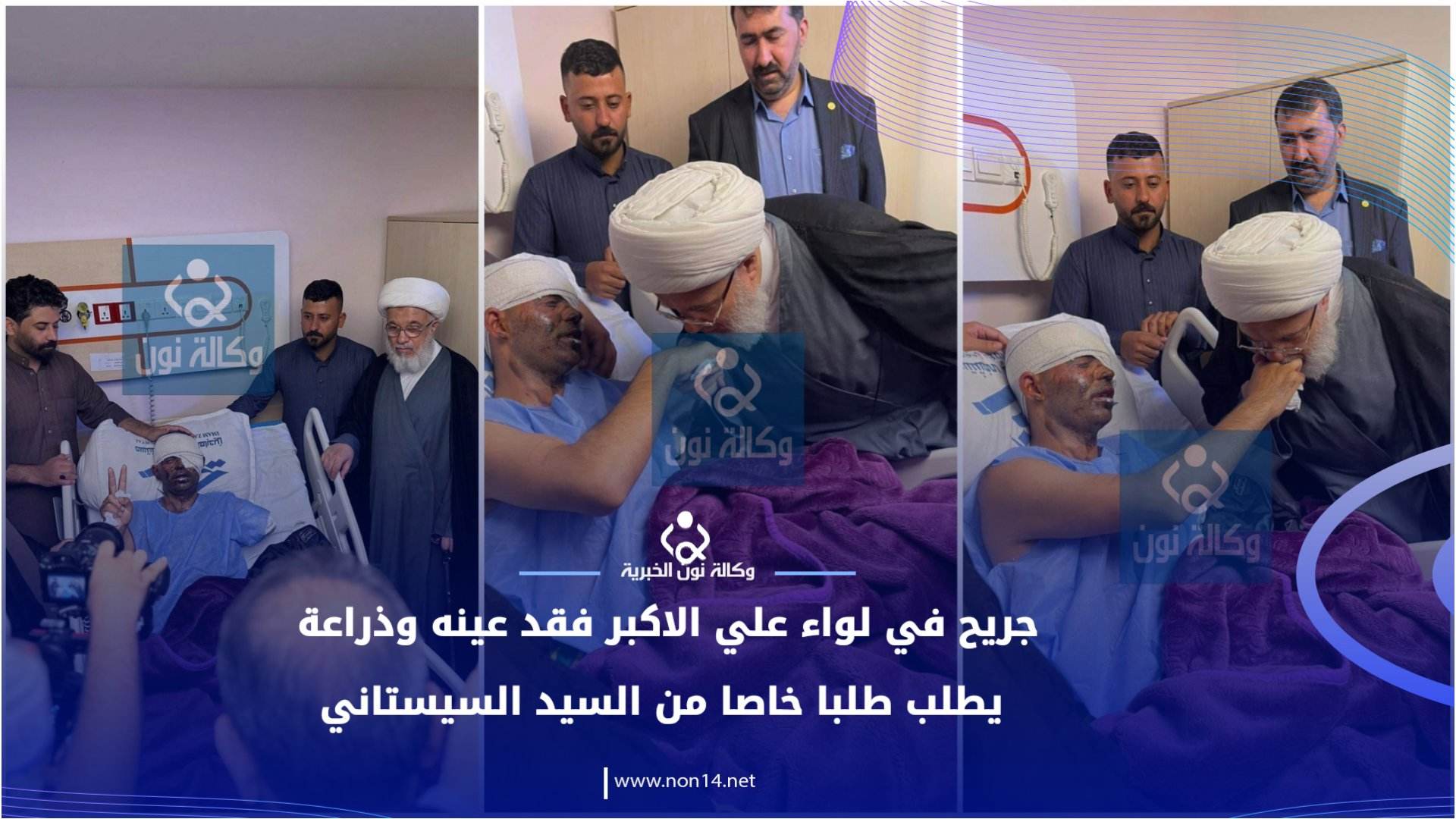 فيديو:جريح في لواء علي الاكبر فقد عينه وذراعة يطلب طلبا خاصا من السيد السيستاني