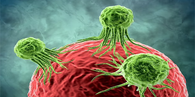 دراسة.. عقار جديد لمواجهة سرطان البروستات