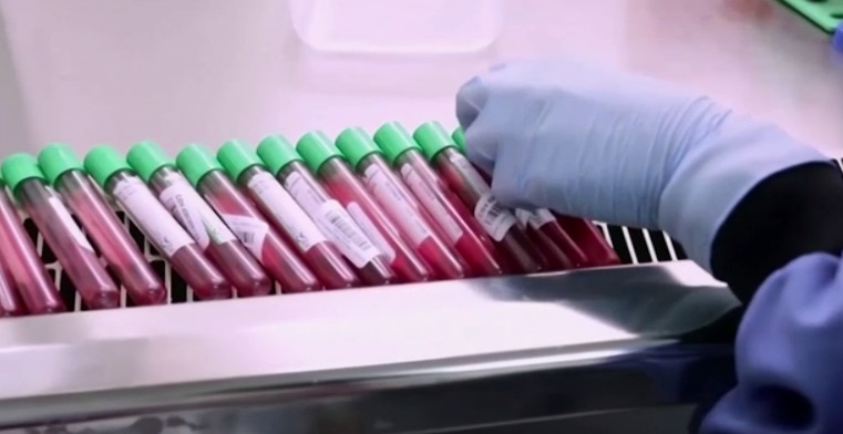 فحص دم بسيط يكشف عن 50 نوعا من أمراض السرطان