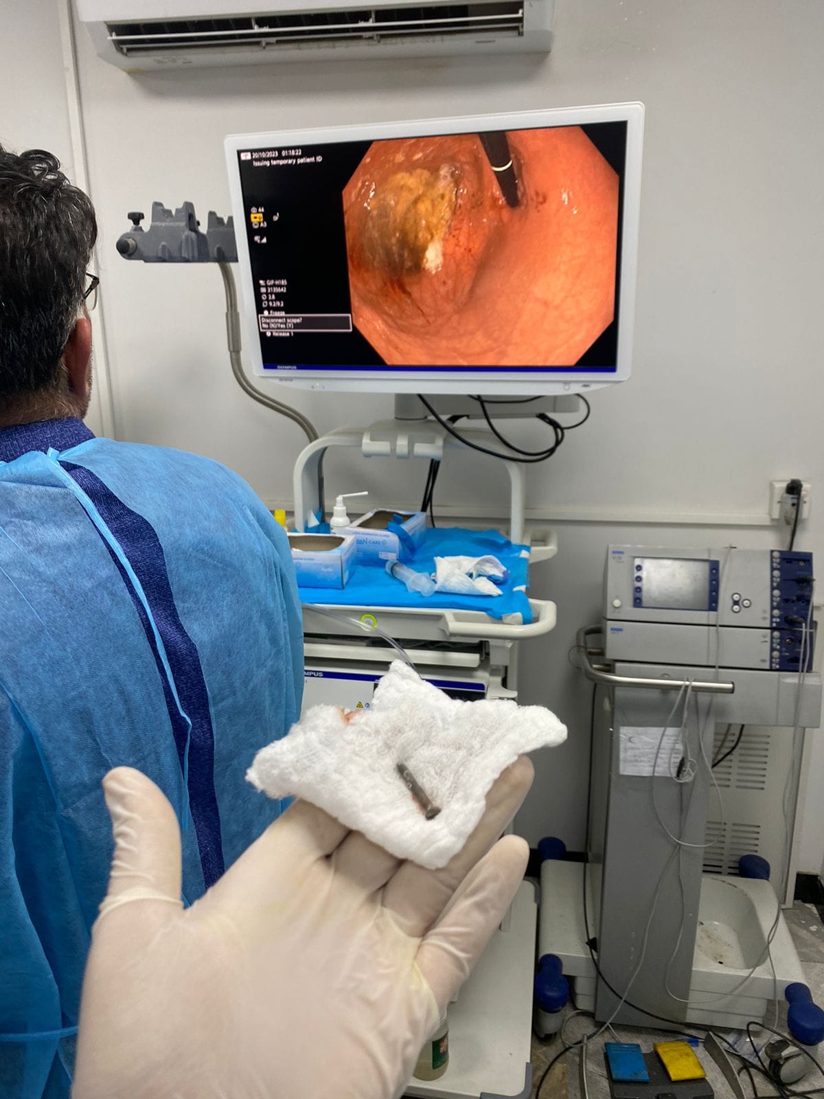 في كربلاء : إستخراج جسم غريب من معدة طفل صغير دون تداخل جراحي