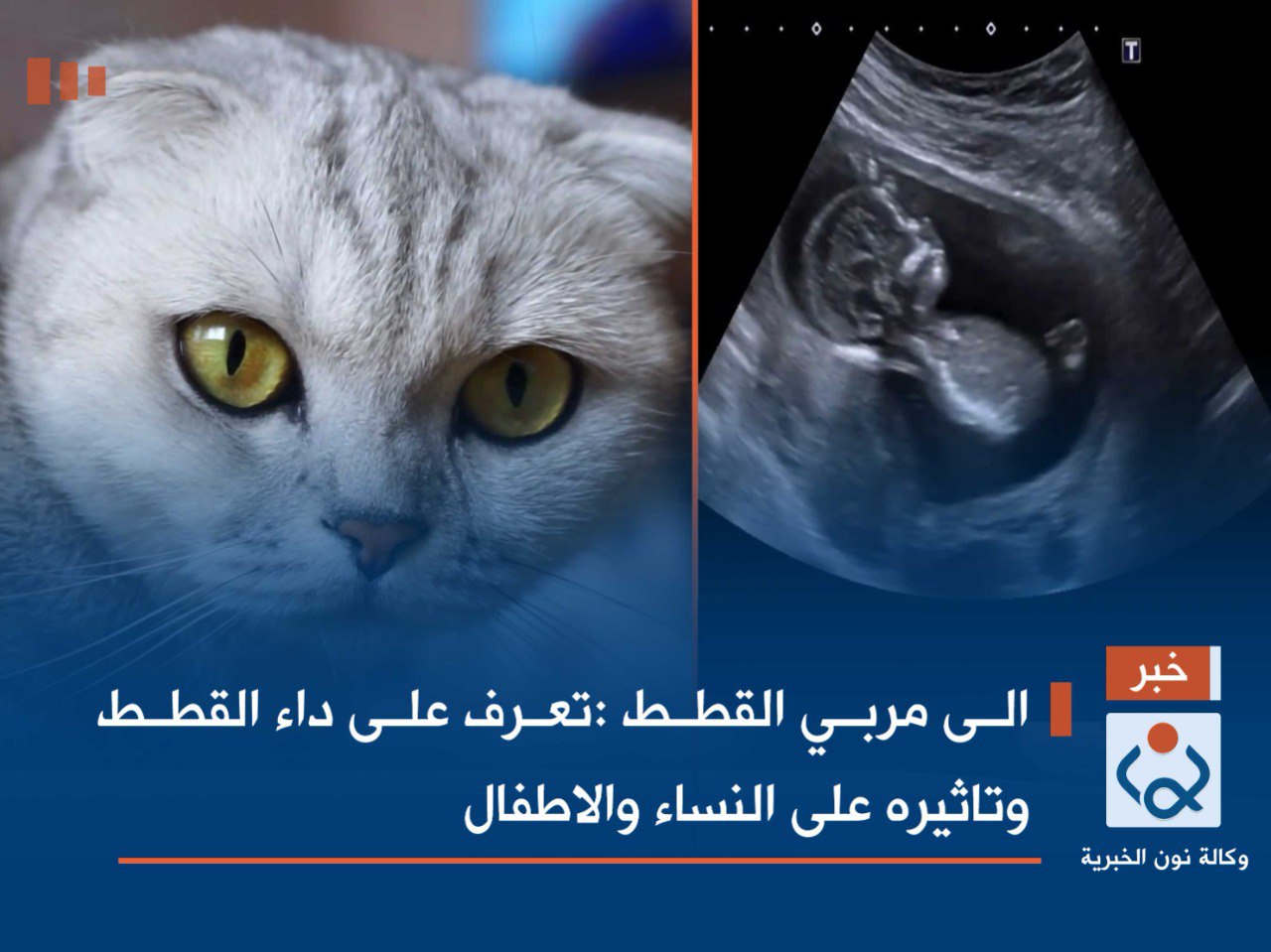 إلى مربي القطط :تعرف على داء القطط وتاثيره على النساء والاطفال (فيديو)