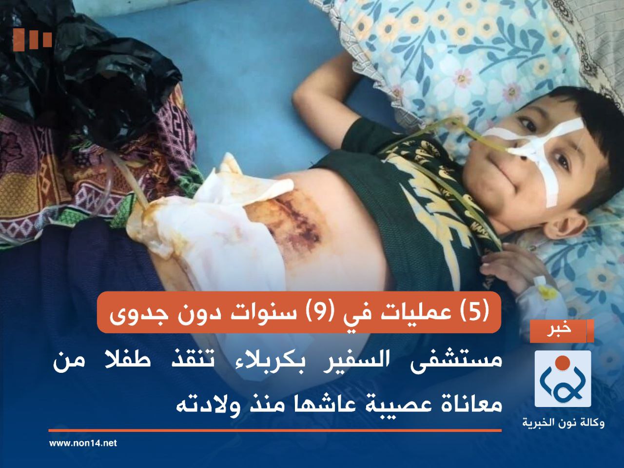 (5) عمليات في (9) سنوات دون جدوى... مستشفى السفير بكربلاء تنقذ طفلا من معاناة عصيبة عاشها منذ ولادته