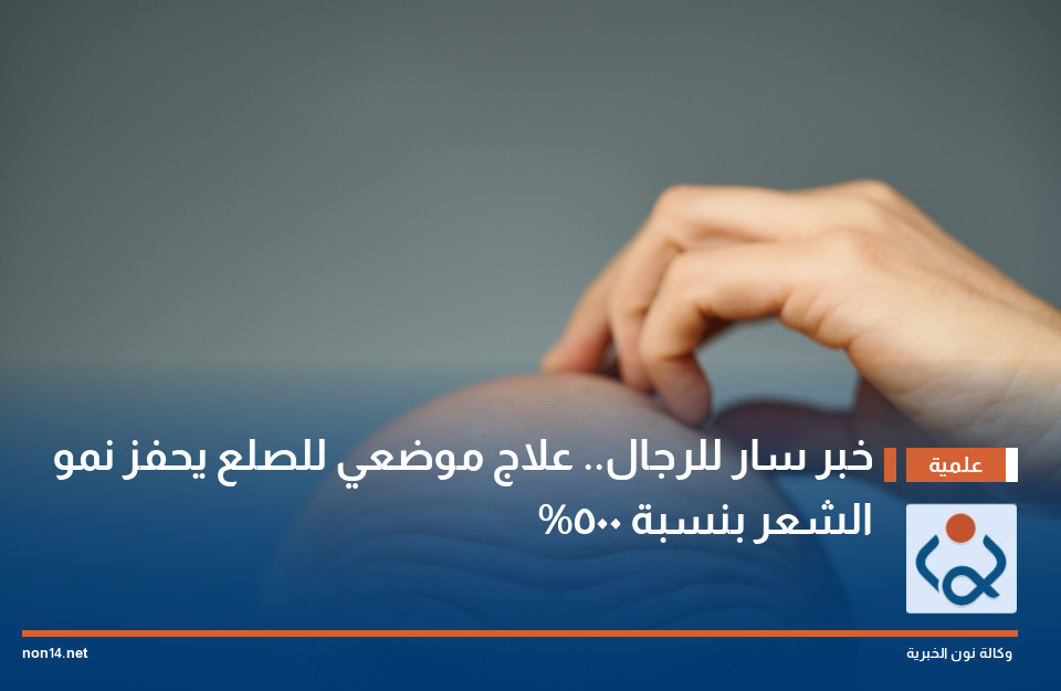 خبر سار للرجال.. علاج موضعي للصلع يحفز نمو الشعر بنسبة 500%