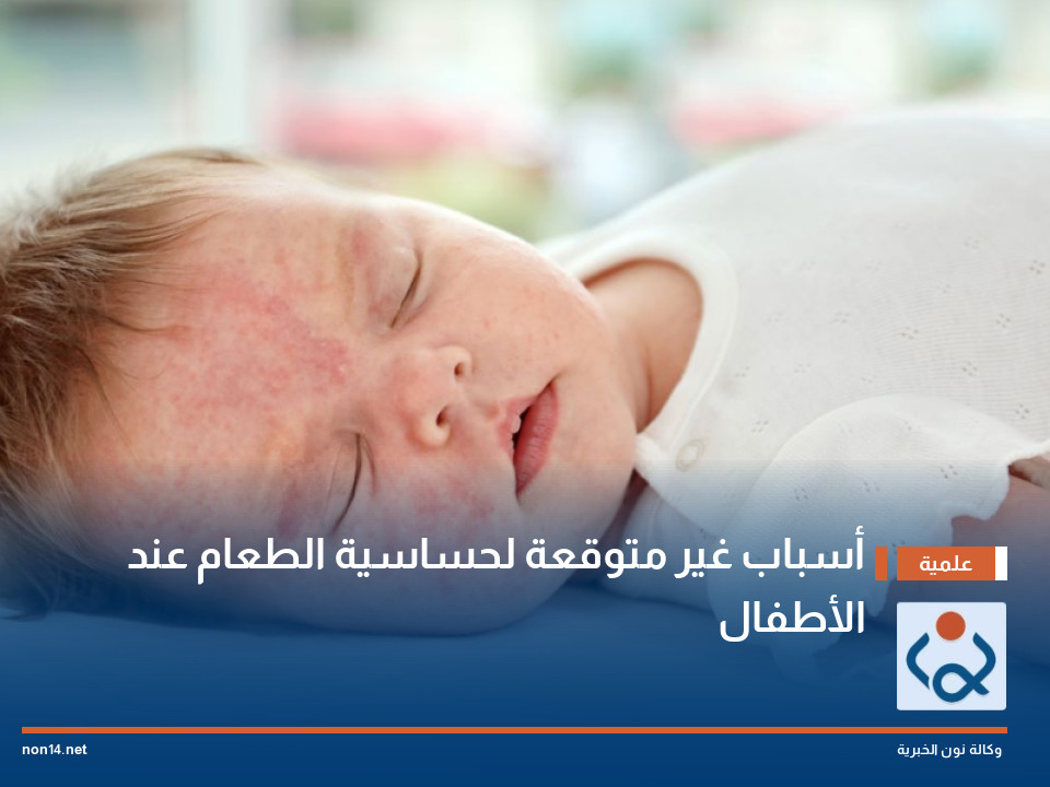 أسباب غير متوقعة لحساسية الطعام عند الأطفال