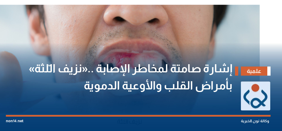 «نزيف الّلثة».. إشارة صامتة لمخاطر الإصابة بأمراض القلب والأوعية الدموية