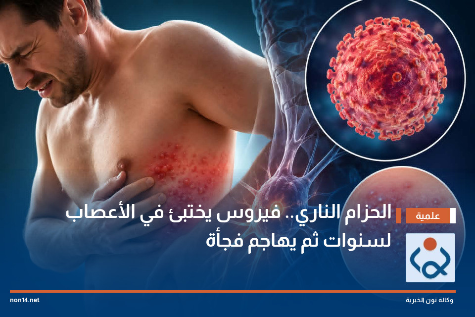 الحزام الناري.. فيروس يختبئ في الأعصاب لسنوات ثم يهاجم فجأة