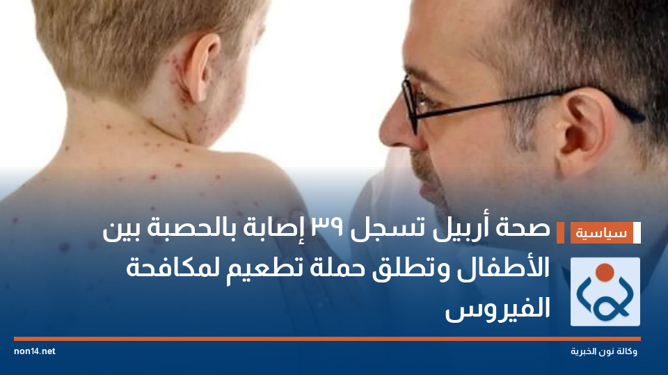 صحة أربيل تسجل 39 إصابة بالحصبة بين الأطفال وتطلق حملة تطعيم لمكافحة الفيروس