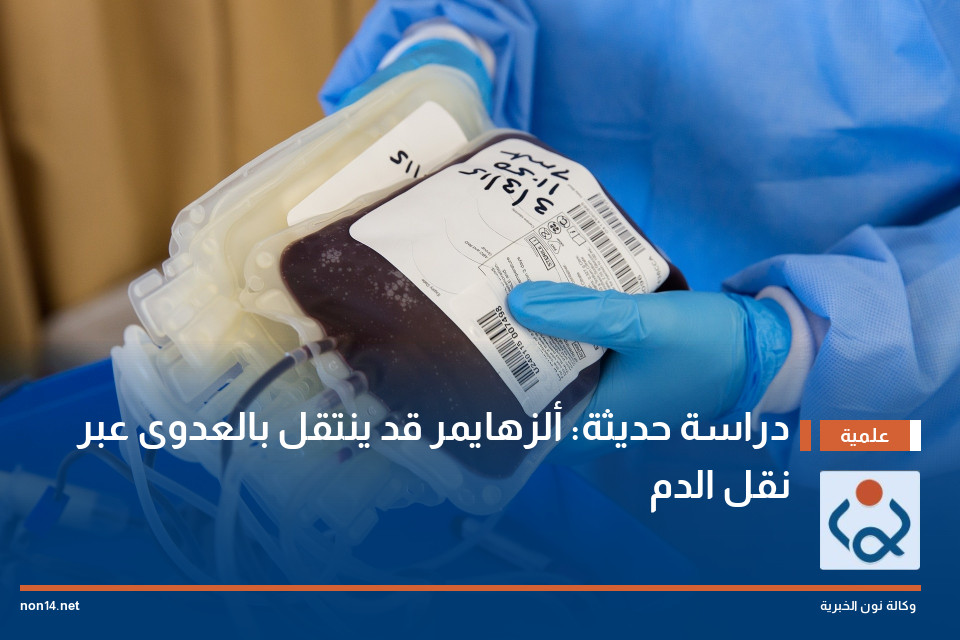 دراسة حديثة: ألزهايمر قد ينتقل بالعدوى عبر نقل الدم