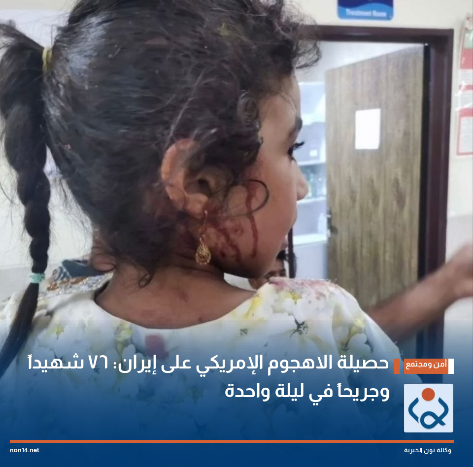 حصيلة الاهجوم الإمريكي على إيران: 76 شهيداً وجريحاً في ليلة واحدة