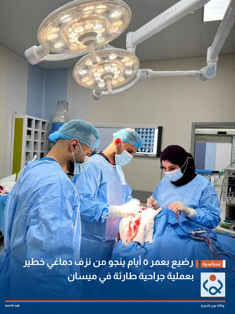 رضيع بعمر 5 أيام ينجو من نزف دماغي خطير بعملية جراحية طارئة في ميسان