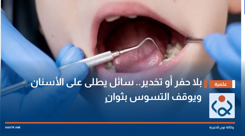 بلا حفر أو تخدير.. سائل يطلى على الأسنان ويوقف التسوس بثوانٍ
