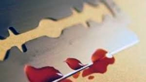 منو ...... بلاع الموس ؟؟؟!