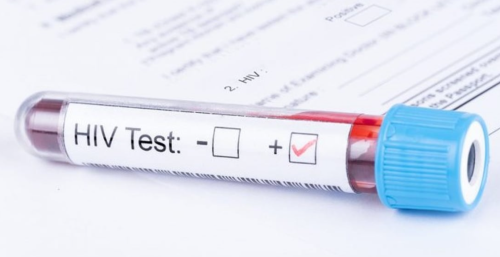 كردستان تعلن تسجيل 87 إصابة جديدة بالإيدز هذا العام معظمها لأجانب